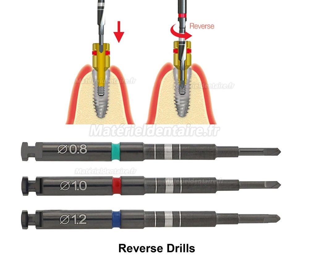 Kit universel d'extraction de vis cassées d'implant compatible avec l'outil de réparation Neobiotech SR